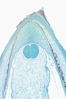Pin - Ovule de Pin CL x7